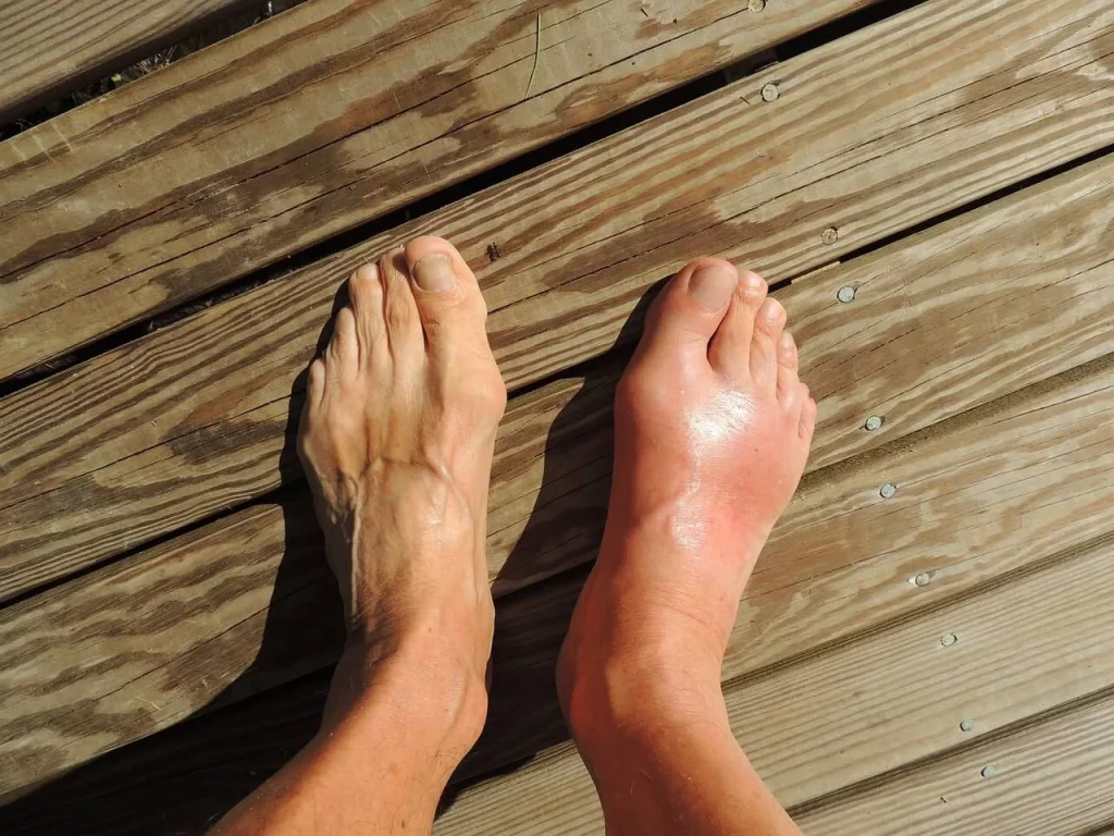 Co powoduje opuchnięte stopy?
